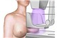 Exame de Mamografia